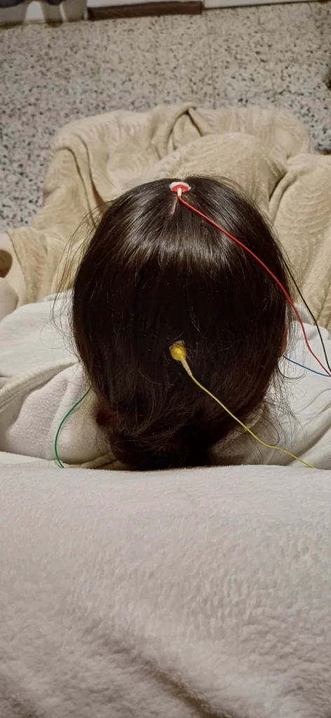 Capteurs de neurofeedback posés sur le cuir chevelu d’une patiente allongée, méthode douce et non invasive Cygnet.